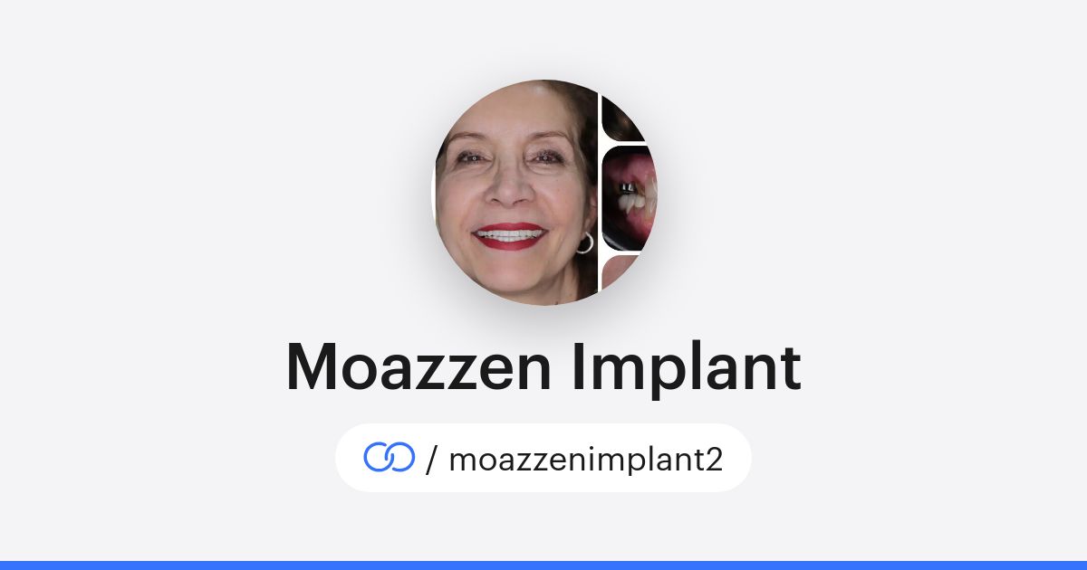 Moozen Moazzen Implant (/moazzenimplant2) · solo.to