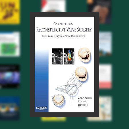 Free Book) Carpentier's Reconstructive Valve Surgery By Al